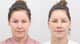 Slider image (6) AB Plastic Surgery